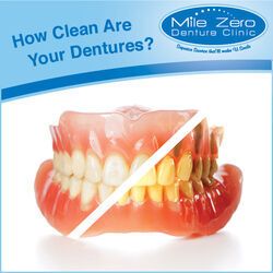 5 Tips for Cleaning Dentures,