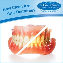 5 Tips for Cleaning Dentures, 