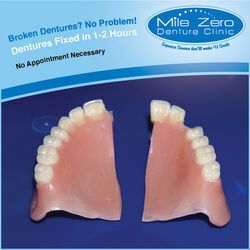 Can Worn Dentures Be Repaired?,
